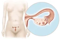 Illustration for a blog post about ovulation.