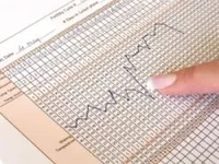 Illustration for a blog post about a cycle observation card – a sample card with a visible temperature chart.