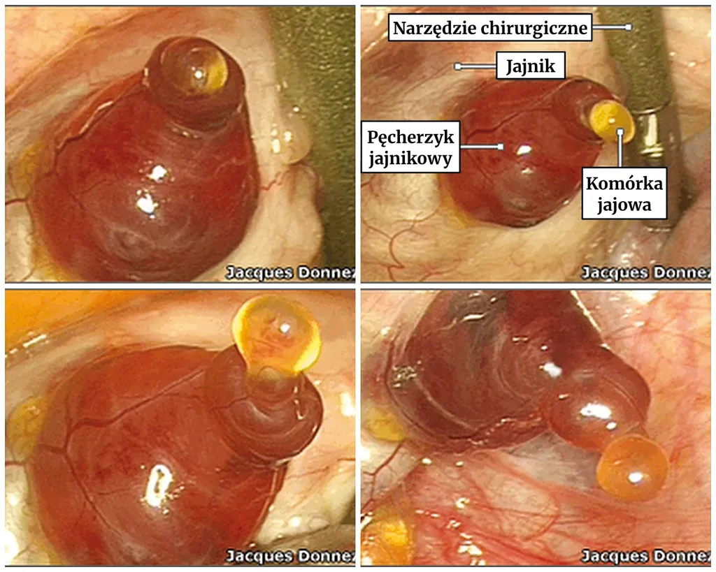 Uchwycony na zdjęciach moment owulacji.