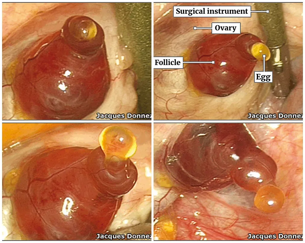 Ovulation moment caught on camera